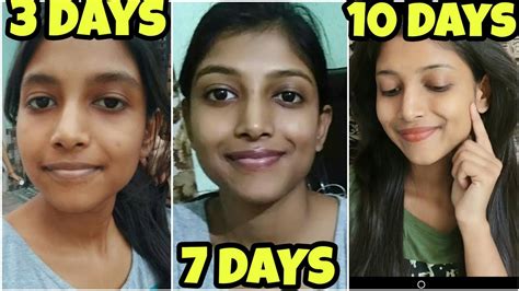 Convert 3 Shades Lighter Skin Tone 😍 By Using Natural Products Youtube