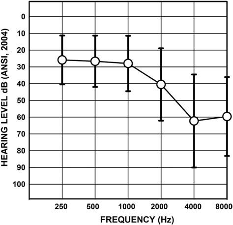 The Mean Right Ear Audiogram And One Standard Deviation Of The