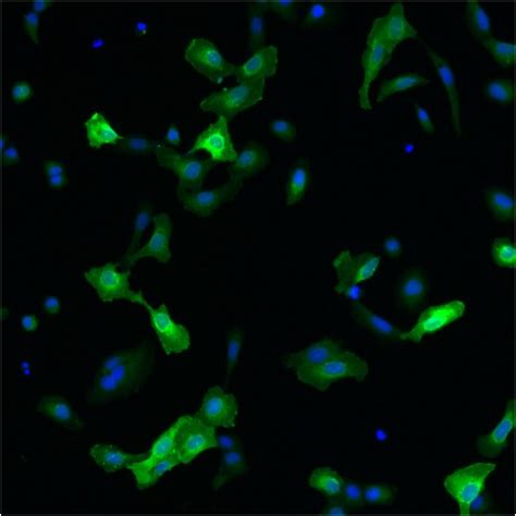 Dylight® is a registered trade mark of thermofisher inc., and its subsidaries. Human RET Chicken Polyclonal Antibody Isoptype IgY | Eagle Bio