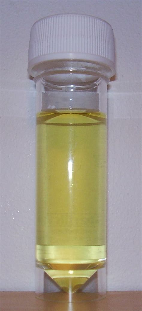 Traditionally, for dna analyses, dna is recovered from buffy coats. Urine - Why Is It Yellow? Consider Its Source