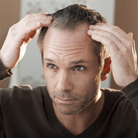 Toupee 101 All You Need To Know About Toupees For Men
