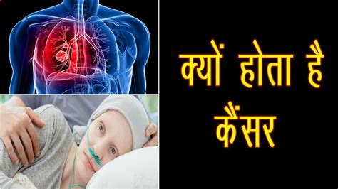 Note also that while the degrees of decans are precise, the dates are necessarily. क्यों होता है कैंसर || World Cancer Day 2020 || Marudhar ...