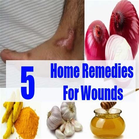Home Remedies For Wounds Home Remedies Remedies Herbs For Health