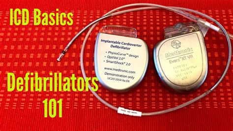 Defibrillators 101 The Basics Of An Implantable Cardioverter