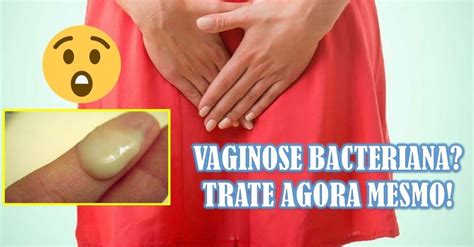 Vaginose Bacteriana O Que Sintomas E Tratamento Sobre A Medicina