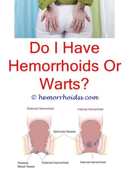 Skin tags are very common in cats. How to remove hemorrhoids skin tags?.Can you put hydrocortisone on hemorrhoids?…. | Bleeding ...