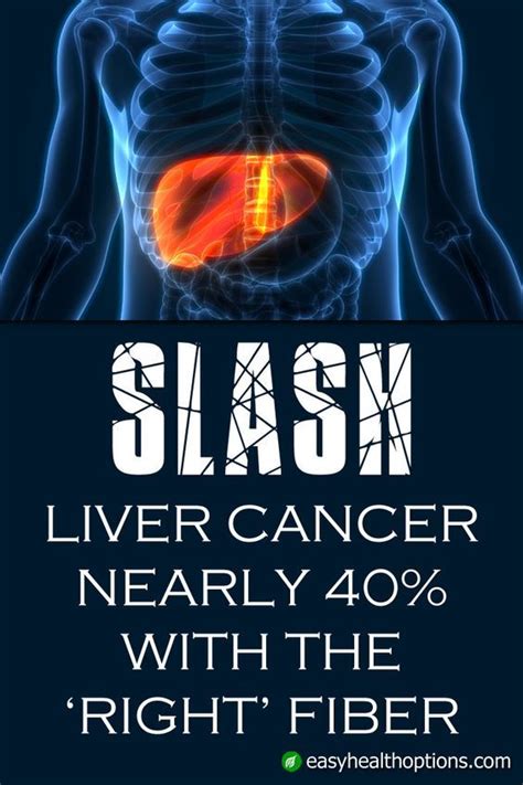 Pin by Fati Londre on Health&Cancer in 2020 | Liver cancer, Cancer, Liver