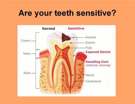 causes of sensitive teeth tooth sensitivity tooth sensitivity relief sensitive teeth