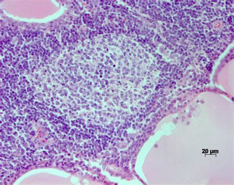 Hande Stain Of The Thyroid Of A Rhesus Macaque With Chronic Lymphocytic