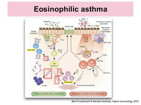Eosinophilic Lung Diseases Elim Rheumatic Centre