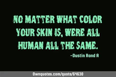 No Matter What Color Your Skin Is Were All Human All The Same