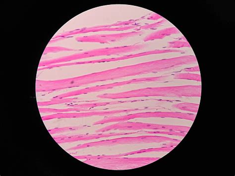 Striations indicate that a muscle cell is very strong, unlike visceral muscles. Histology Of Human Skeletal Muscle Under Microscope View ...