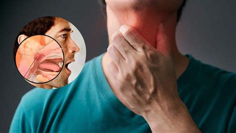 Throat Cancer 6 Unusual Symptoms Of Larynx Cancer That May Show Up In