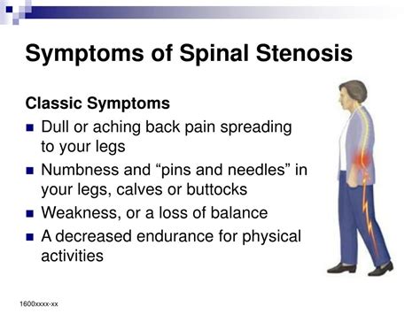 Ppt Lumbar Spinal Stenosis Symptoms And Treatment Powerpoint