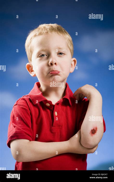 Boy With Scraped Elbow Stock Photo Alamy