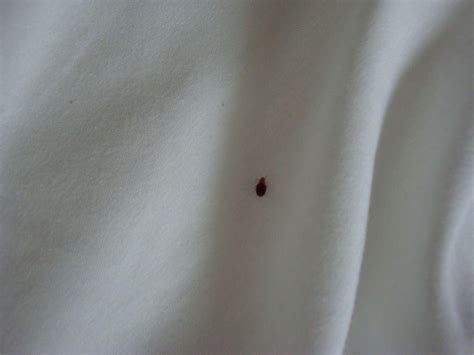 Der feind im bett hat sechs dünne beine und will blut sehen. Bild "Ungeziefer im Bett" zu Hotel Oasis Inn in San Francisco