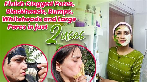 Finish Clogged Pores Blackheads Bumps Whiteheads And Large Pores In
