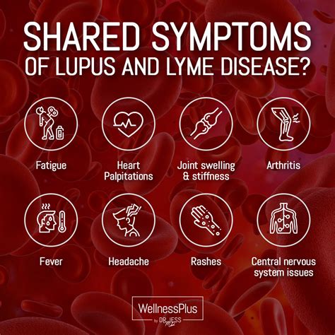 Is It Lupus Or Lyme Disease Wellnessplus By Dr Jess