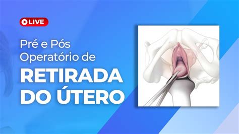 Cuidados antes e depois da histerectomia Pré e pós operatório de