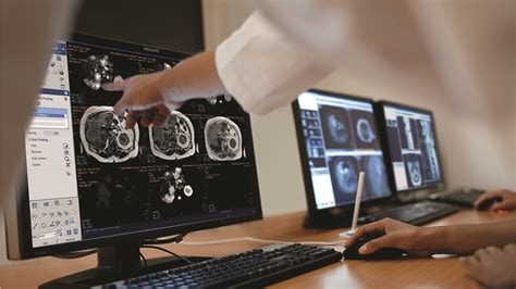 How Virtual Radiology Can Help Meet The Goal Of Healthforall Blog
