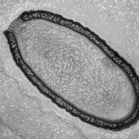 Giant Virus Resurrected From Permafrost After 30000 Years Live Science