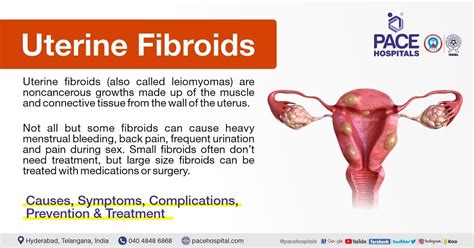 How Do Fibroids Cause Infertility Women S Pelvic Surgery Of Santos