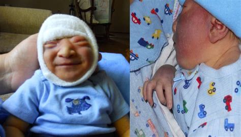 Baby Gabriel Only Lived 10 Days After Birth But His Life Proves Every