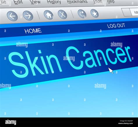 Skin Cancer Concept Stock Photo Alamy