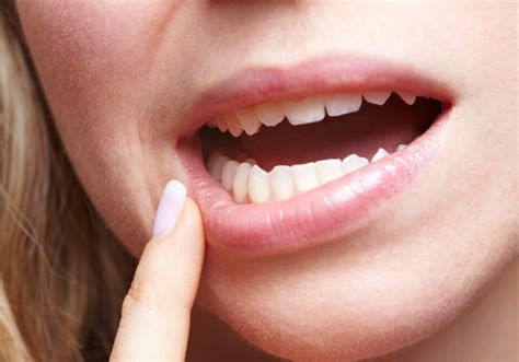 How To Get Rid Of Black Spots On Teeth Near Gums Diagnosis And Treatment