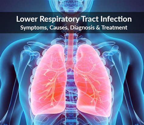 Lower Respiratory Tract Infection Symptoms Causes Diagnosis