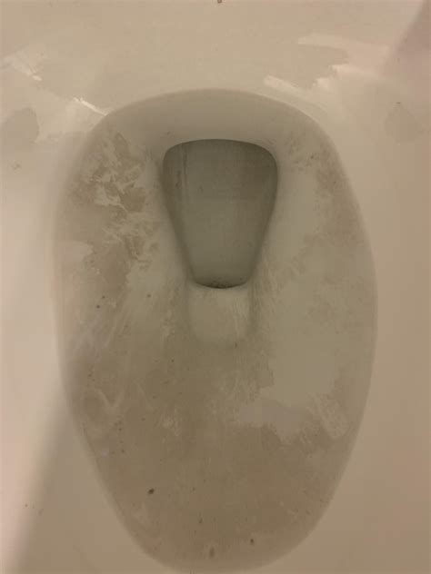 What Is This Toilet Bowl Growth R Cleaningtips