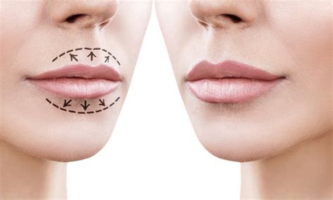 3 Tips Rias Ala Makeup Artist Untuk Mempertebal Bibir Tipis