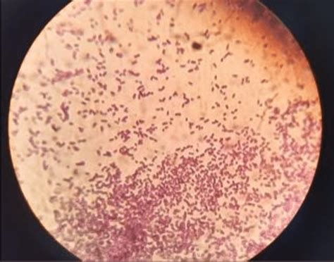 Microscope View Of Bacillus Subtilis After Gram Staining Download