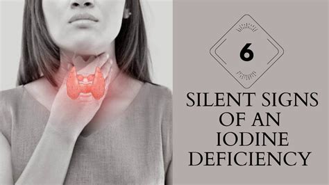 Early Signs Of Iodine Deficiency 6 Signs And Symptoms Of Iodine