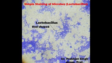 Simple Staining Of Bacteria Lactobacillus Youtube