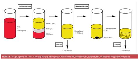 Platelet Rich Plasma Preparation Photograph By Pikovi Vrogue Co