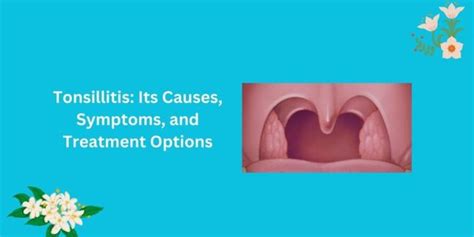 Tonsillitis Its Causes Symptoms And Treatment Options