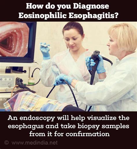 Eosinophilic Esophagitis Eoe Allergic Esophagitis Causes