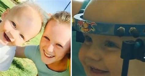 Surgeons Reattach Toddlers Head After He Is Decapitated In Car Crash
