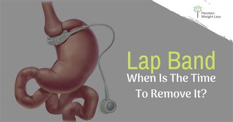 When Is The Time To Remove Lap Band Houston Weight Loss Surgical