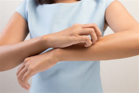 How Long Do Eczema Rashes Last Advanced Dermatology Center