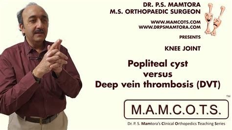 Knj9 Knee Popliteal Cyst Versus Deep Vein Thrombosis Dvt Mamcots