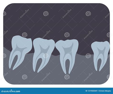 Gingiva Cartoons Illustrations And Vector Stock Images 2026 Pictures