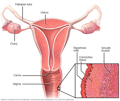 Vaginal Cancer Disease Reference Guide