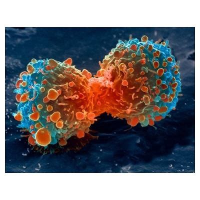 We did not find results for: Lung cancer cell division, SEM | Science- biology ...