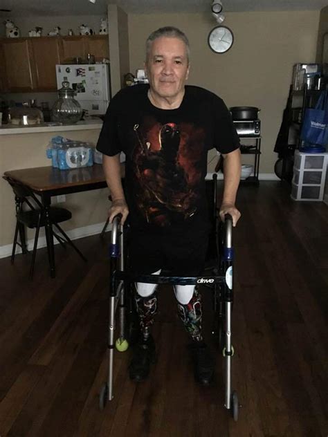 My Father After Losing His Legs In 2018 Dons His Marvel Themed
