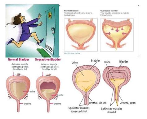 Treatment For Frequent Urination Problems Urologists In Chennai Dr