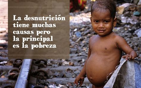 La Desnutrición En Guatemala La Desnutrición En Guatemala