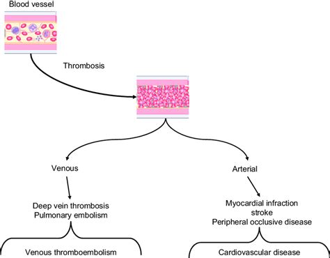 Pathogenesis Of Venous And Arterial Thrombosis Download Scientific