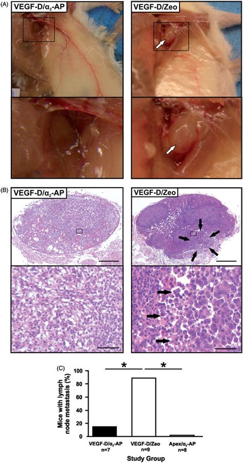 Effect Of A 2 Ap On Vegf D Driven Metastasis To Lymph Nodes Axillary